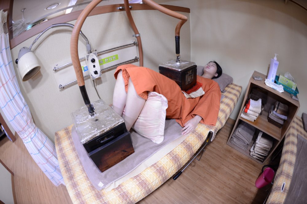 경희온가족한의원 허리 왕뜸 시술 모습